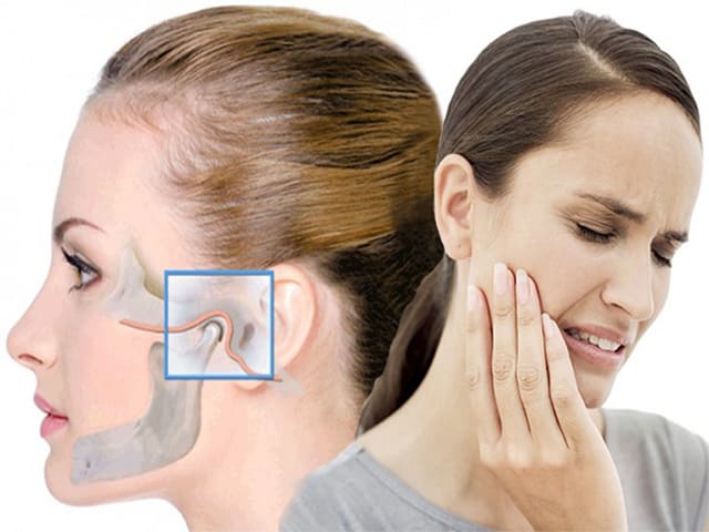 артроз челюстно лицевого сустава
