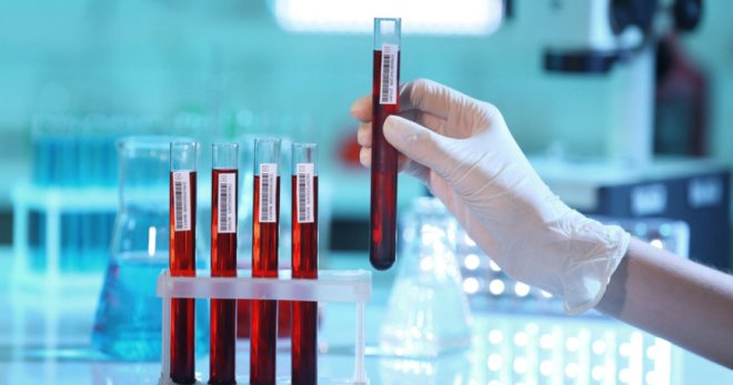 Ревматоидный фактор в анализе крови – для чего и как определяют показатель?