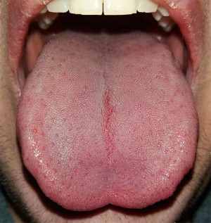 extreme close up of wide, flat tongue