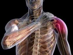 Симптомы и признаки вывиха плечевого сустава
