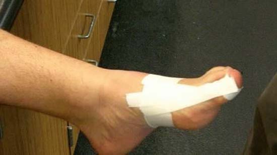 Первая помощь при травме ногтя на ноге