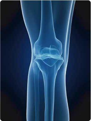 болезнь гоффа коленного сустава лечение