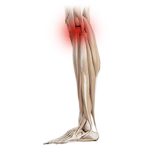 Поврежденное колено