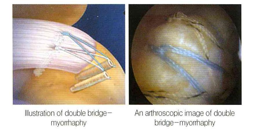 https://wooridulhospital.files.wordpress.com/2015/01/orthopedic-shoulder-clinic-3.jpg