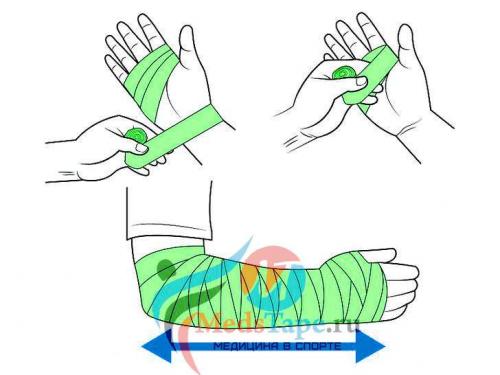 Как правильно бинтовать руку эластичным бинтом при ушибе. Часть 1: Перевязка поврежденного запястья