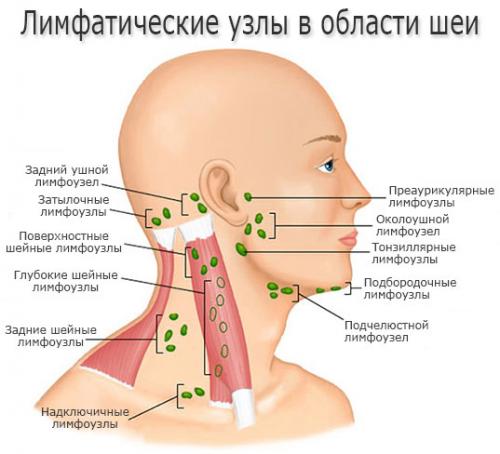 Быстро вылечить лимфоузлы. Общая информация о лимфоузлах