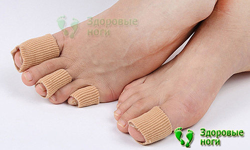 Не только корректоры при молоткообразных пальцах ног помогут в лечении, но и защитная гелевая трубка