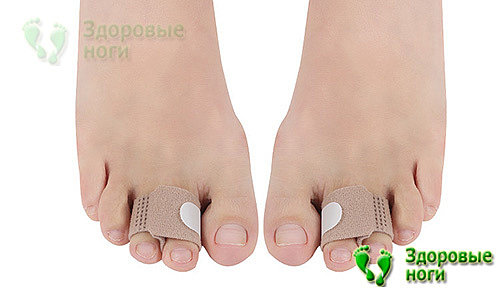 Бандаж при молоткообразных пальцах ног необходимо применять регулярно